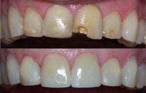 Before and after a visit to our dentist in Tucson, AZ