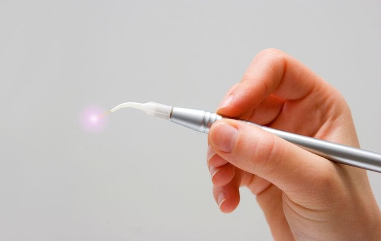 Teeth Whitening in Tucson, AZ
